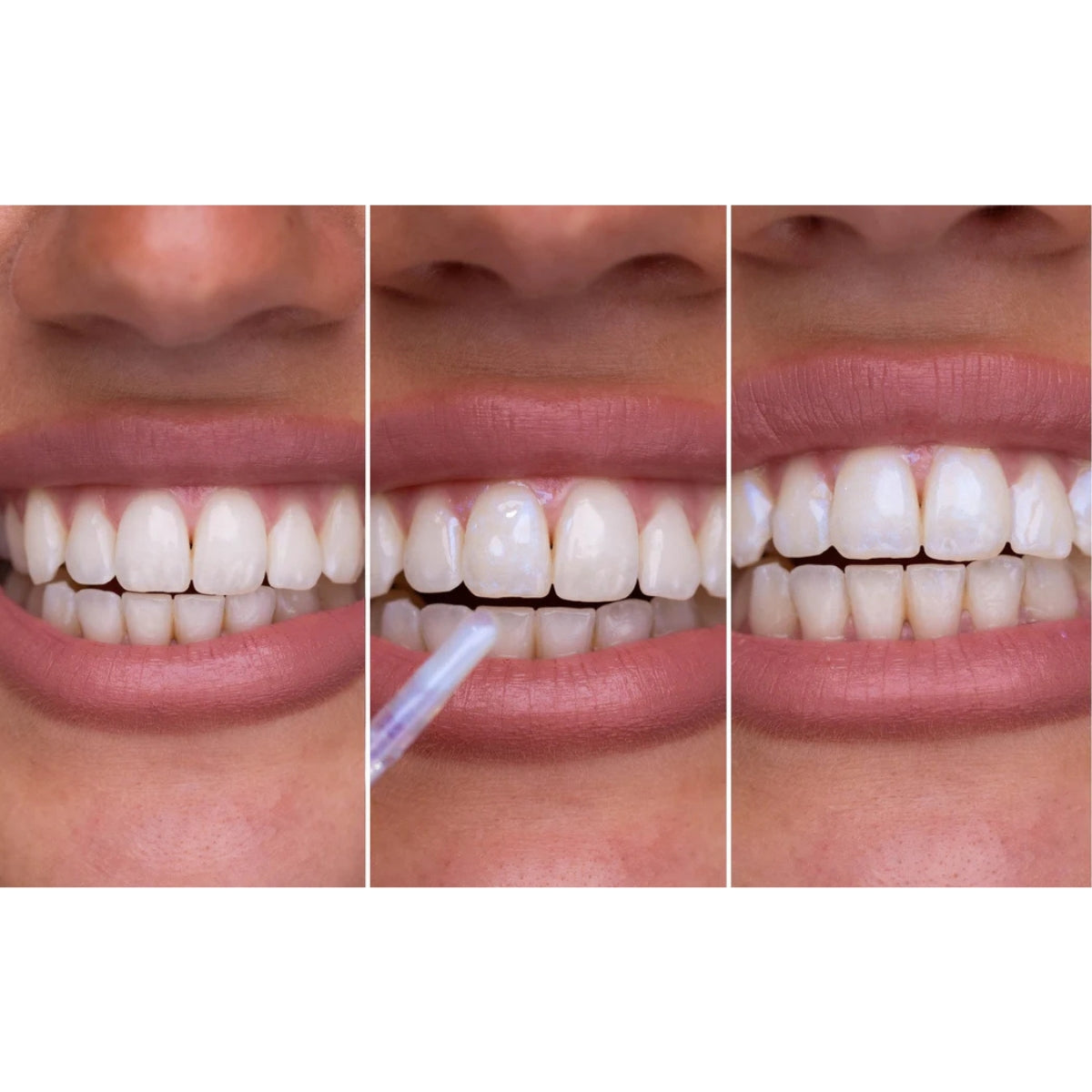 Glostik Tooth Gloss