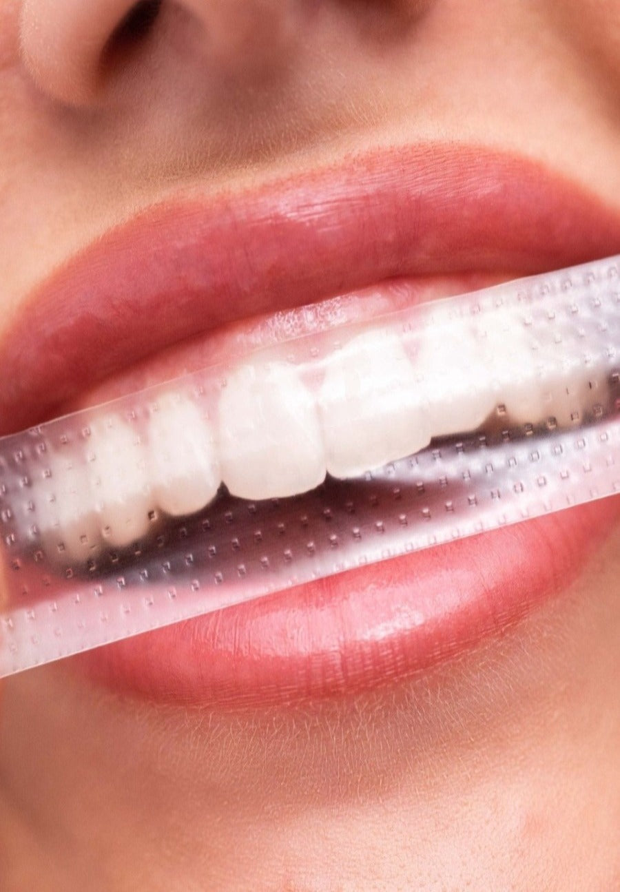 smiling woman with teeth whitening strips on teeth